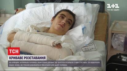Угрожал, издевался и побил до крови: ТСН пообщалась с жертвой 45-летнего киевлянина