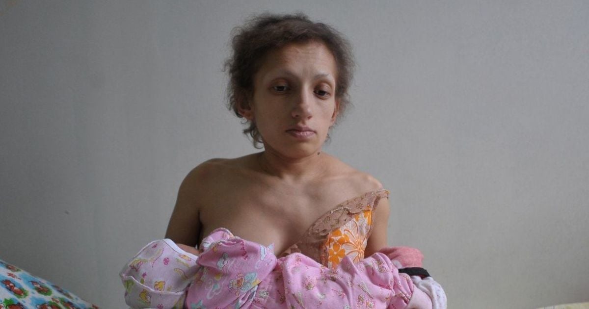 В Червонограде умерла самая низкая в Украине мама: женщина имела рост 96 см