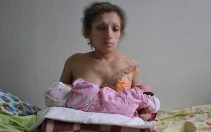 В Червонограде умерла самая низкая в Украине мама: женщина имела рост 96 см