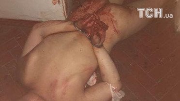 Штурм лікарні у Львові_4 / © facebook/Ігор Зінкевич