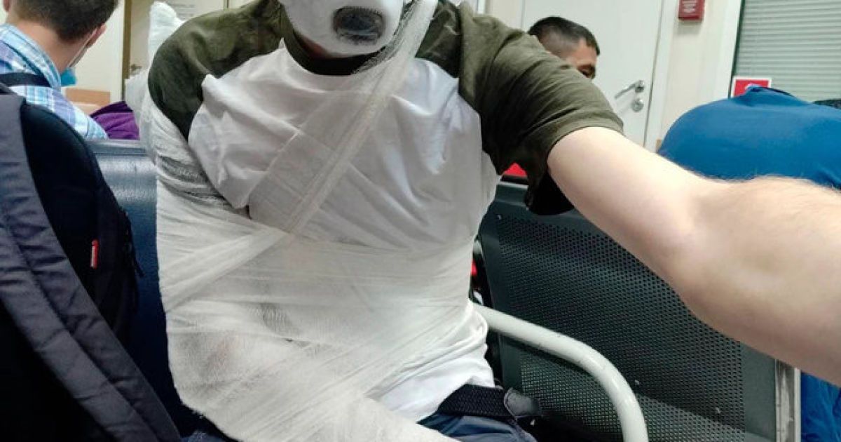 Полицейский сломал руку журналисту, который освещал голосование по поправкам в Конституцию РФ