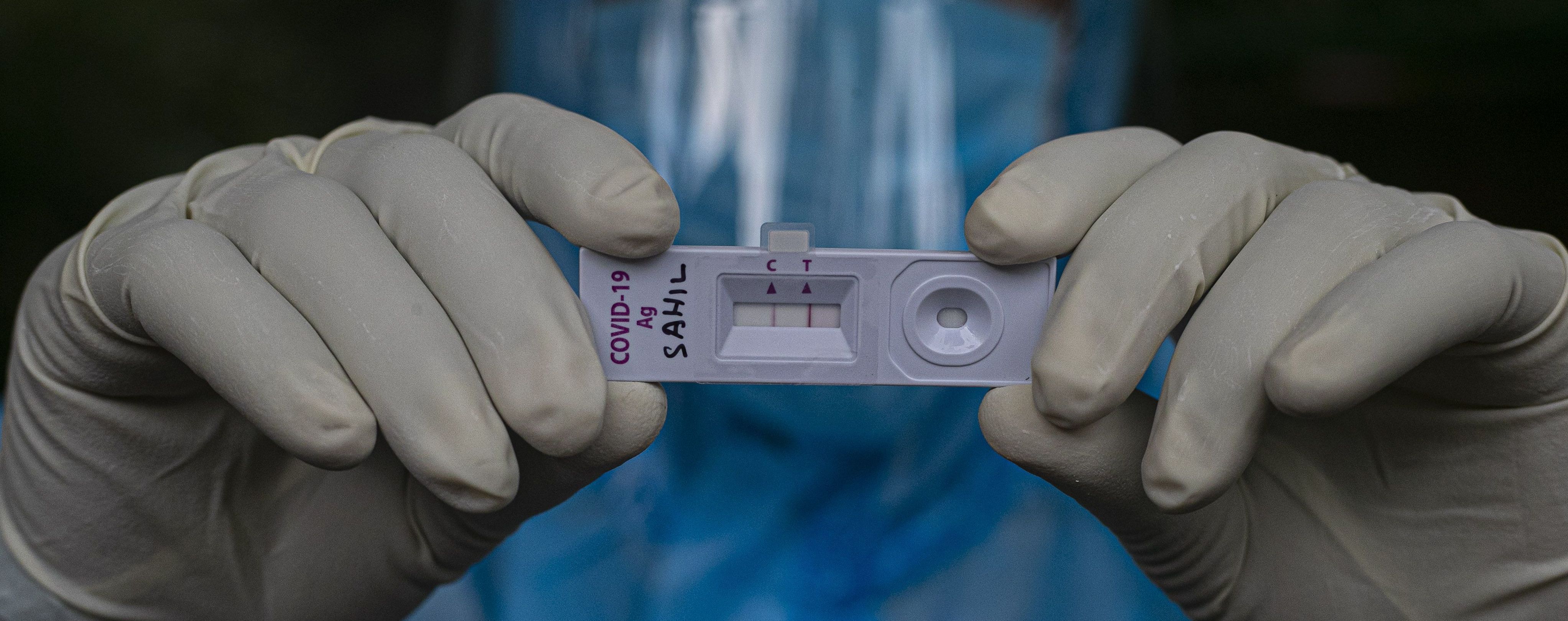 В Британии разработали новый быстрый тест на коронавирус