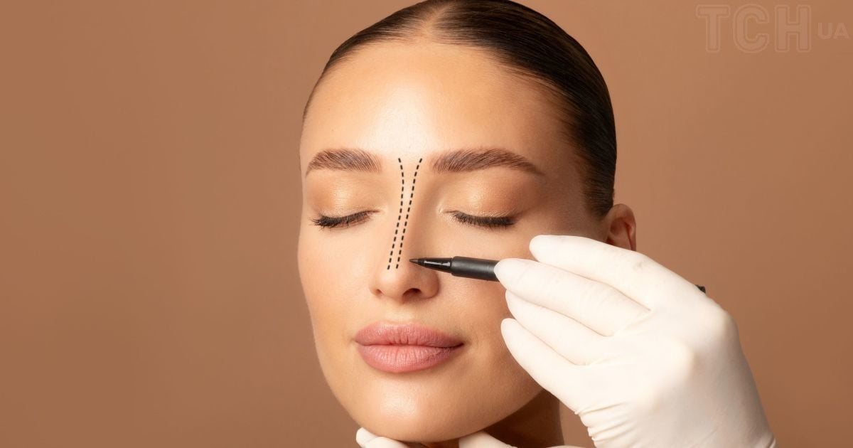 Ринопластика: види, їхні переваги і недоліки