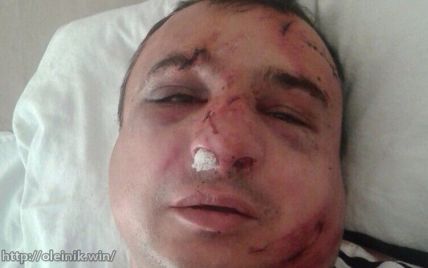 В Киеве жестоко избили главного луганского сепаратиста Клинчаева