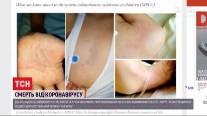 У Кропивницькому мати відмовилася від шпиталізації доньки: за добу дитина померла від коронавірусу