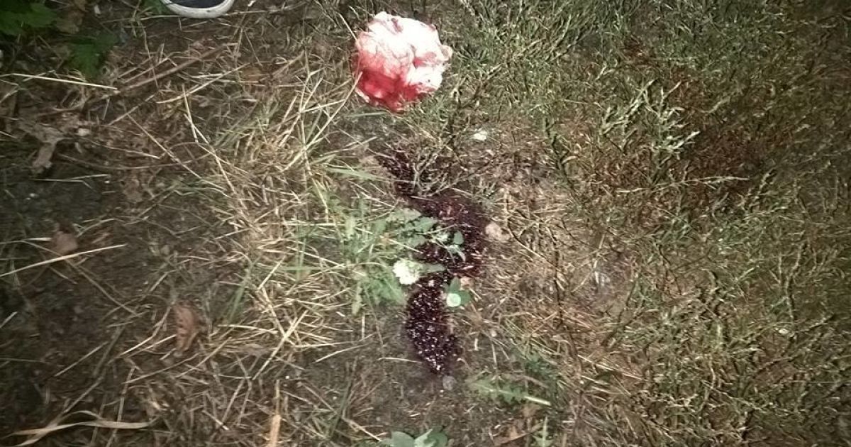 Бійка підлітків під Києвом / © ГУ Національної поліції в Київській області