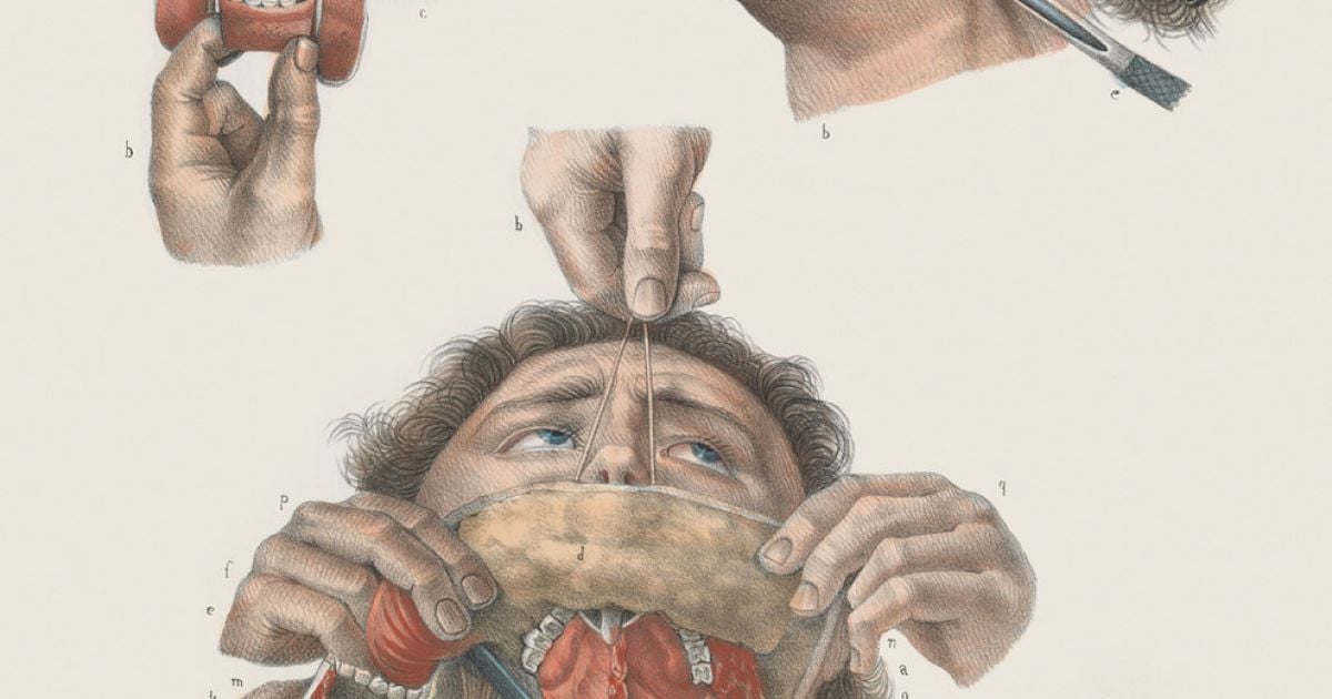 Хірургія 19-го століття. / © thamesandhudson.com
