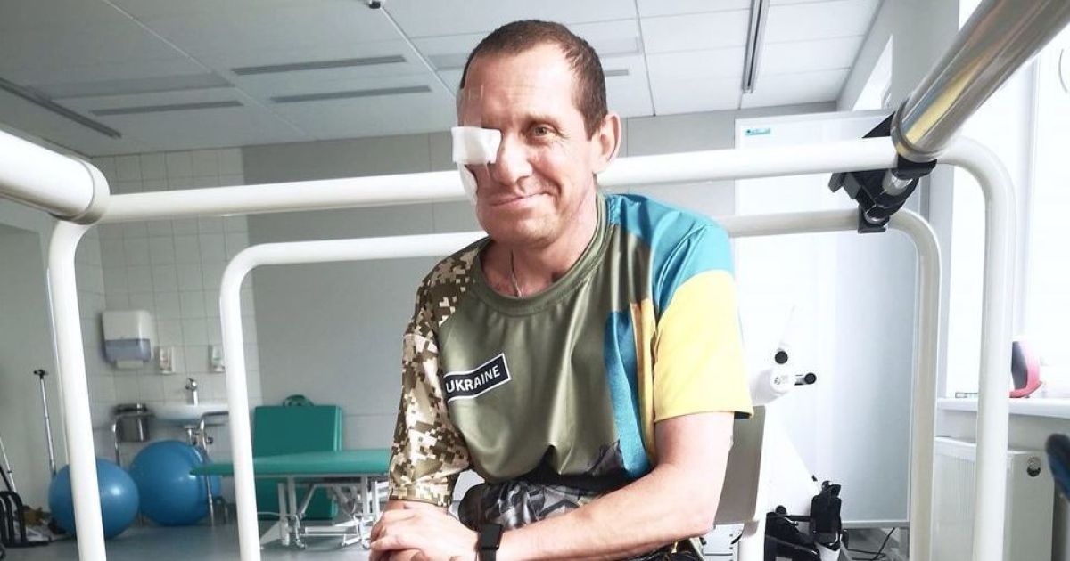 хірурги відновили обличчя військовому за допомогою титанових протезів. Фото: Перше медичне об'єднання Львова.
