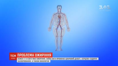 Ожирение является одной из главных причин преждевременной смерти во всем мире