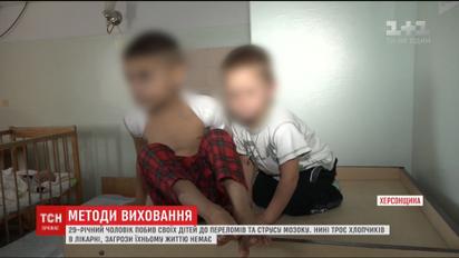 На Херсонщині батько побив трьох своїх дітей до переломів і струсу мозку