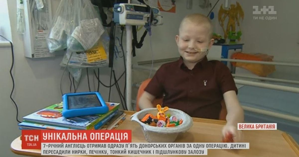 Унікальну пересадку одразу 5 органів провели британські лікарі