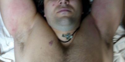 Медики розповіли, коли випишуть з лікарні вбивцю поліцейських Пугачова