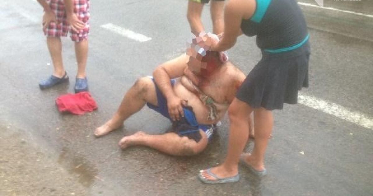 Під Миколаєвом сталася стрілянина, є поранені