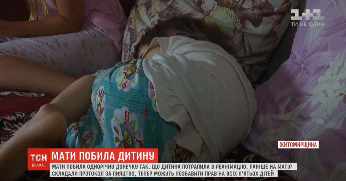 Синий ребенок: родная мать избила годовалую девочку