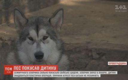 На Кіровоградщині пес напав на 7-річного господаря під час гри