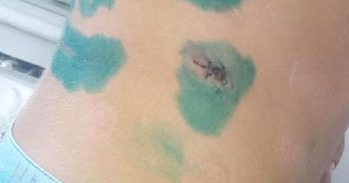 У Дніпропетровській області собака пошматував дитину