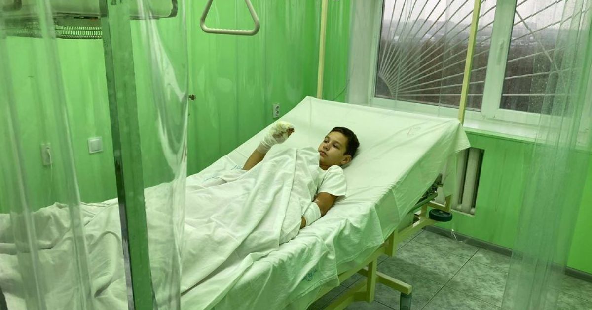 "Хотіли трохи облити і одразу загасити": хлопчик з Бердянська, якого підпалили товариші, розповів подробиці