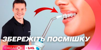 Всі секрети зубного догляду в одному відео: експерт стоматології Назарій Михайлюк
