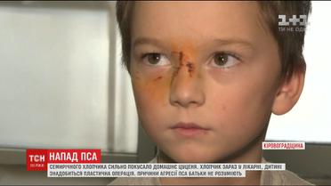 Домашній пес породи маламут вкусив свого семирічного господаря за обличчя