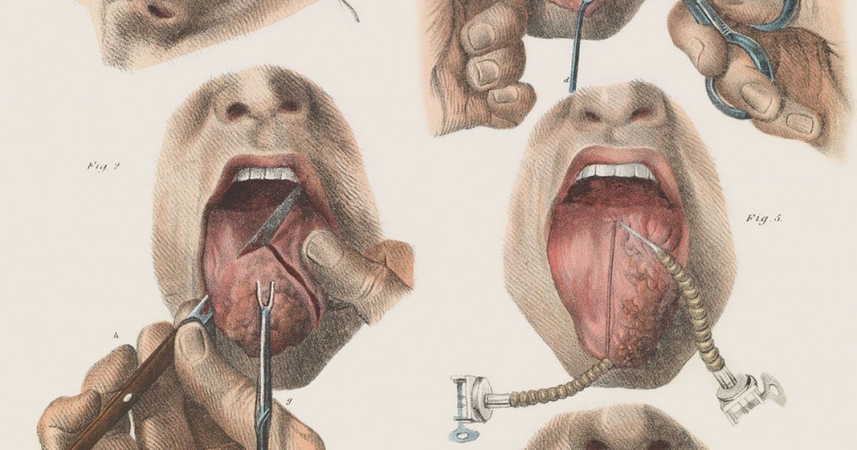 Хірургія 19-го століття. / © thamesandhudson.com
