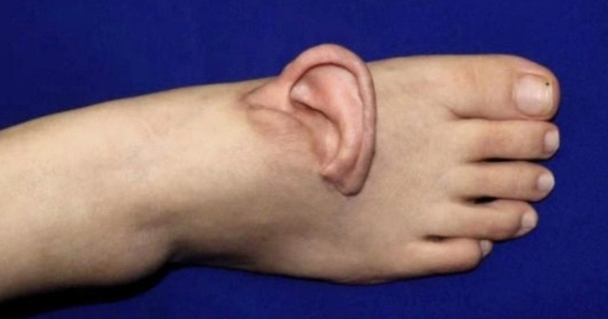 Вухо на стопі