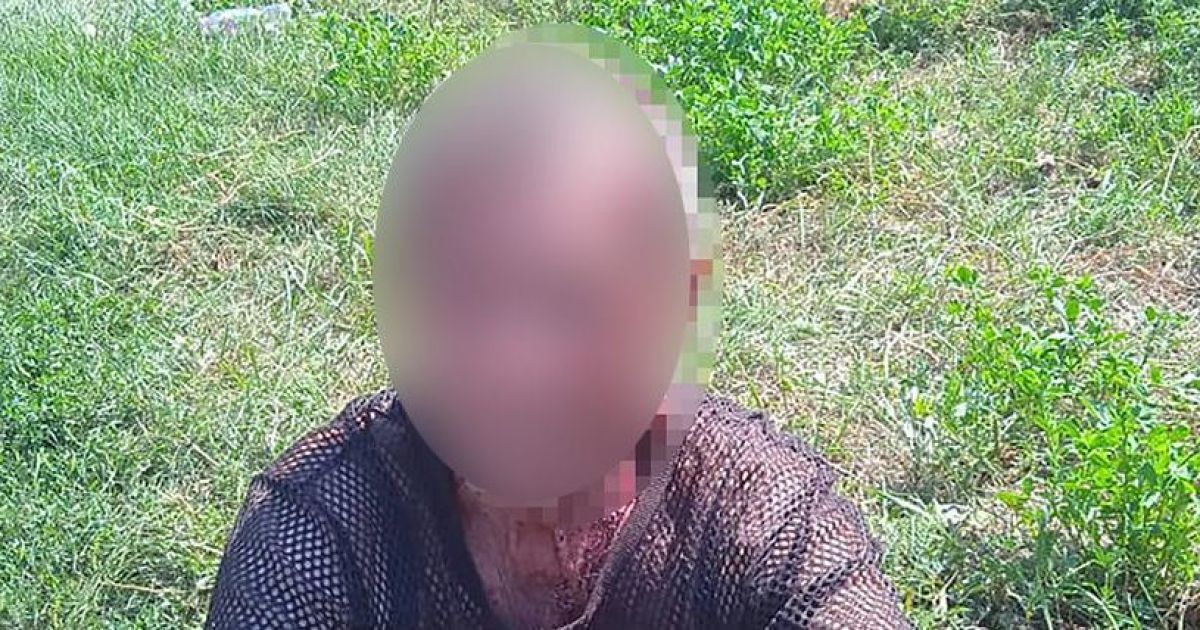 На Запоріжжі дід-таксист "Шпіля" скалічив пасажирку та патрульного: як почуваються потерпілі у ДТП
