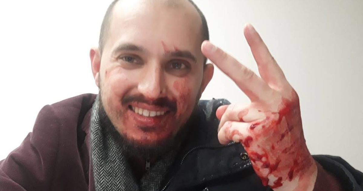 Журналист обвинил охранников Кличко в избиении во время съемки кортежа. Мэр пообещал разобраться