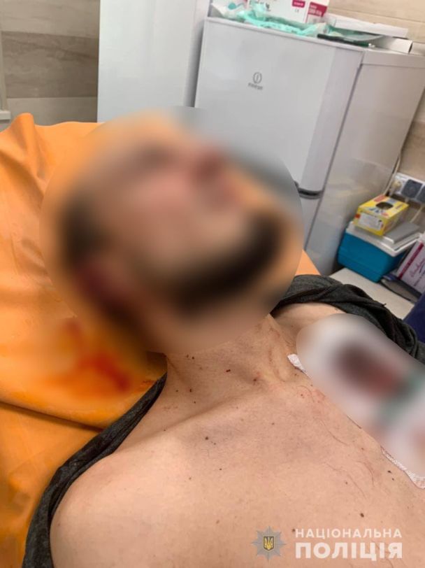 / © ГУ Національної поліції в Черкаській області