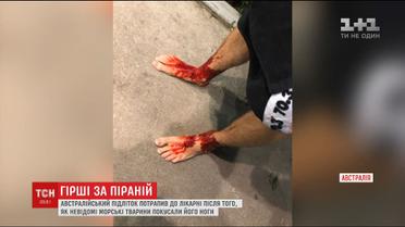 Невідомі морські істоти перетворили ноги австралійського підлітка на криваве місиво