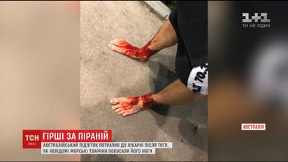 Невідомі морські істоти перетворили ноги австралійського підлітка на криваве місиво