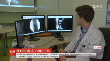 Українські науковці надрукували на 3D-принтері сталеві кістки для дівчини, яка не могла ходити