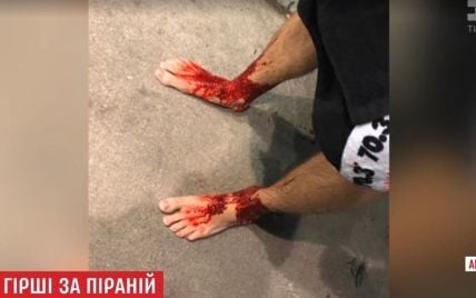 Стоковые фотографии по запросу Кровавый ноги