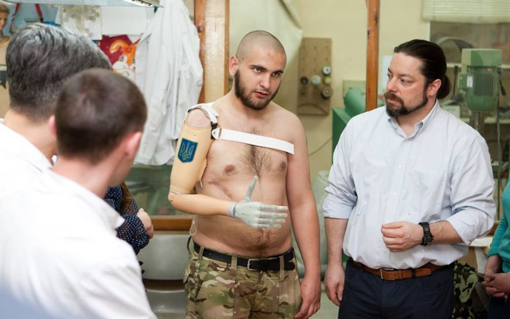 Василий получил протез с трезубцем на предплечье / © пресс-служба канала "1+1"