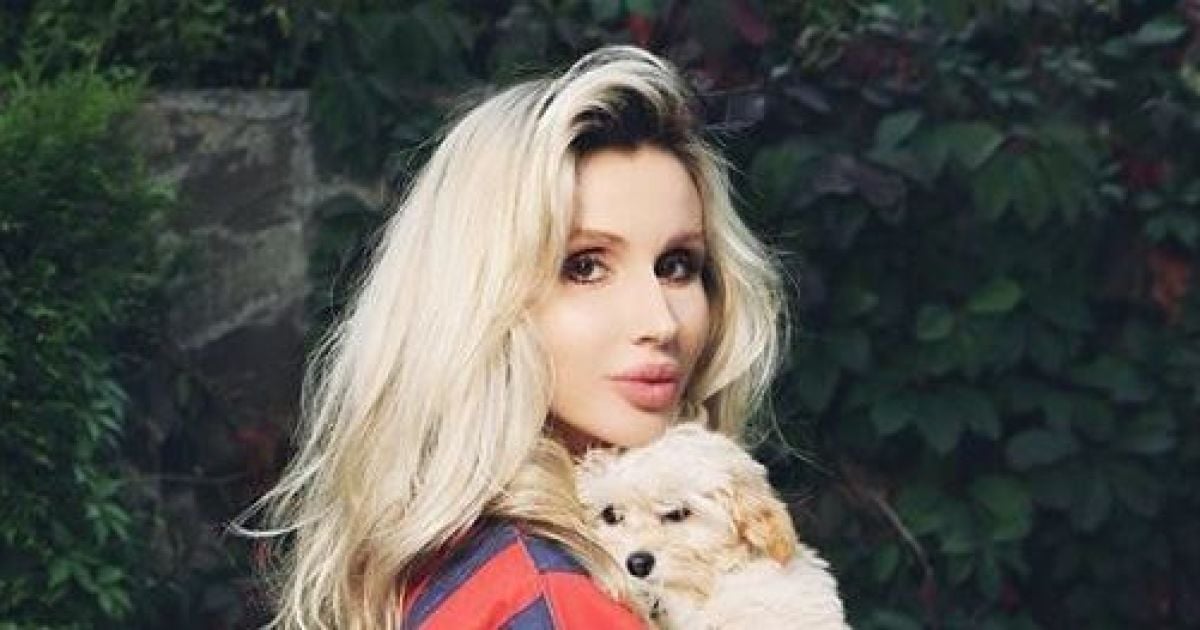Светлана Лобода впервые публично рассказала, как чуть не потеряла почку
