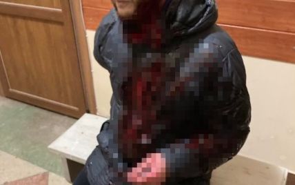 Не впустили, бо боялись: закривавлений чоловік на Львівщині оббивав пороги двох лікарень у пошуках допомоги