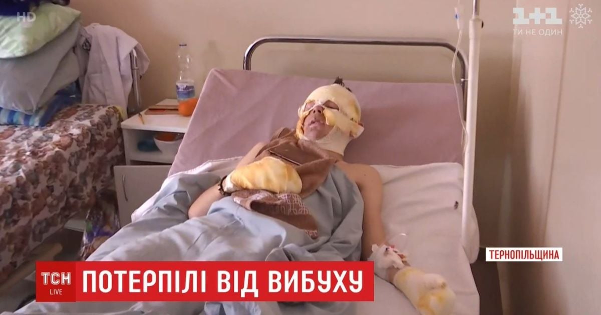 Лікарі розповіли, в якому стані перебувають постраждалі від вибуху у сільському клубі хлопчики