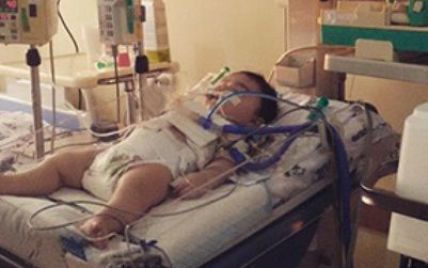 У Вірменії помер поранений російським солдатом шестимісячний малюк