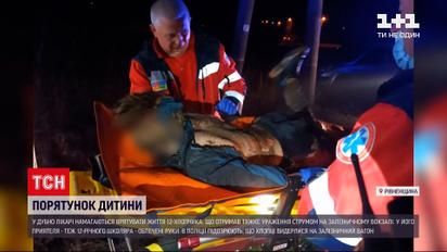 Новости Украины: в Дубно спасают подростка, получившего 90% ожогов тела от поражения током