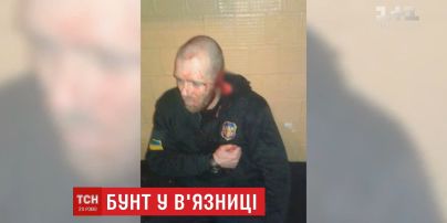 Протест, конфлікт чи доказ: у Лук'янівському СІЗО екс-боєць батальйону "Торнадо" відрізав собі вухо