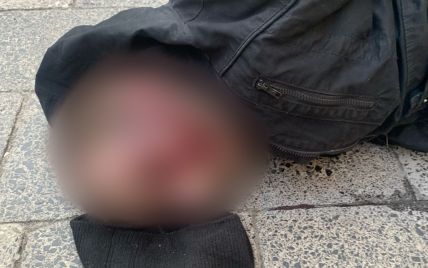 Невідомий з бритвою напав на студентку у вбиральні університету у Львові: як усе закінчилося (фото)