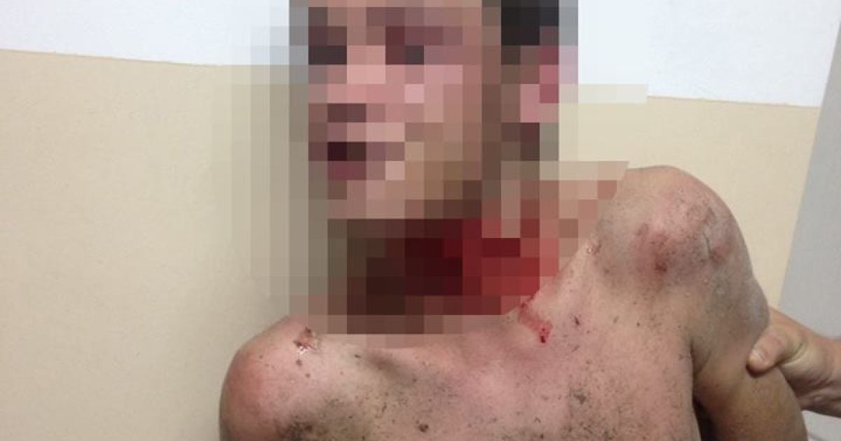 У Житомирі чоловік кидався у перехожих камінням і намагався перерізати собі горло