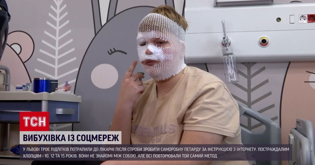 Парень, получивший ожоги лица.