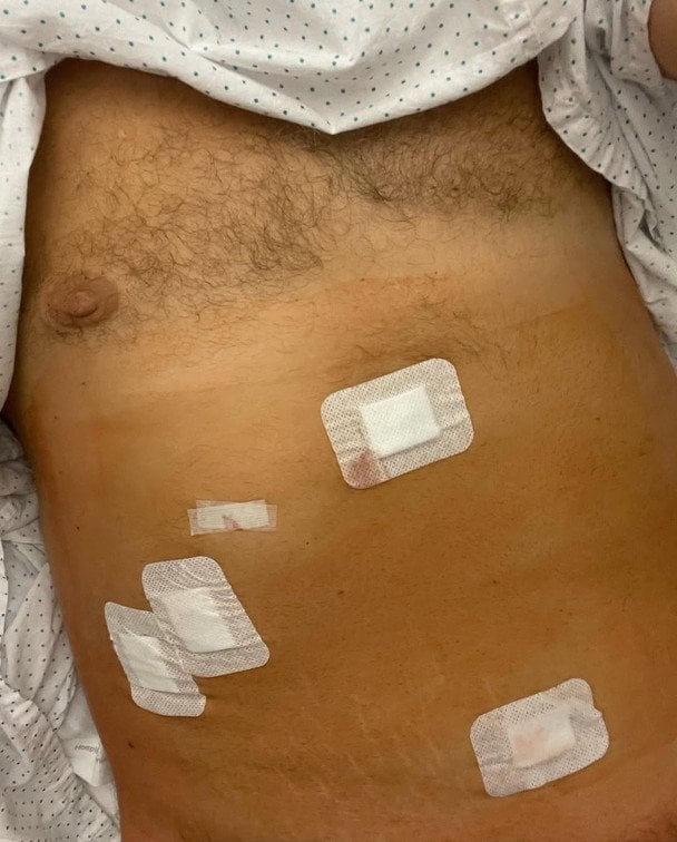 Потап після операції / © www.instagram.com/realpotap