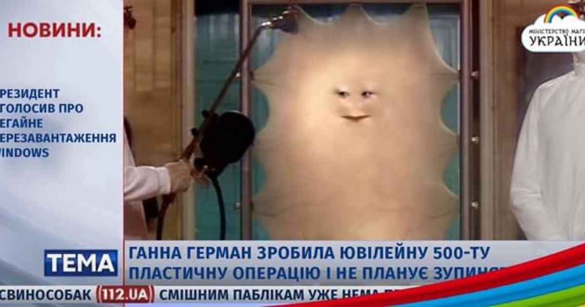 Уничтожение веры в пластическую хирургию: соцсети насмехаются с Анны Герман