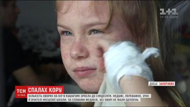 Количество больных корью на Запорожье увеличилось до 70