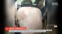 Гематома и ушибы ребер: задержаннный российской полицией журналист-расследовать попал в больницу