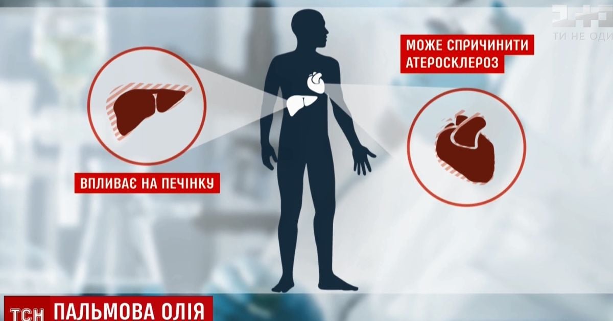 Противники і прихильники заборони пальмової олії навели свої аргументи журналістам
