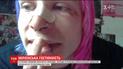 В центрі столиці серед білого дня невідомі побили британського туриста
