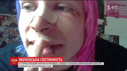 В центрі столиці серед білого дня невідомі побили британського туриста