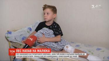 Разорванное колено и пята: в столице пятилетнего мальчика покусала соседская собака
